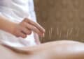 Needles, Knots and Nudges- A Guide to Alternative Therapies for Pain and Injury