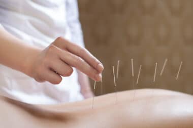 Needles, Knots and Nudges- A Guide to Alternative Therapies for Pain and Injury