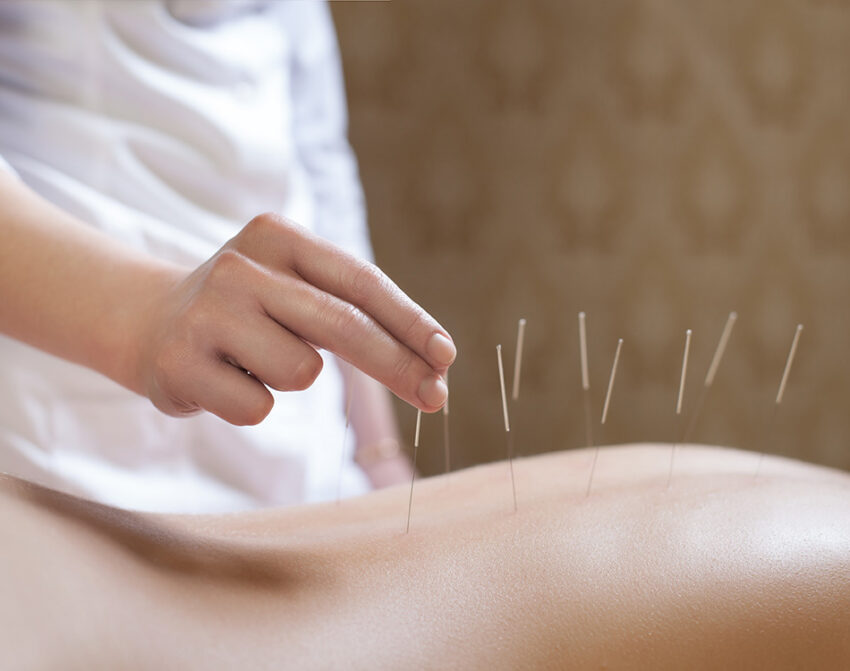 Needles, Knots and Nudges- A Guide to Alternative Therapies for Pain and Injury